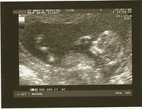 090723_baby2_12_wk_scan_01