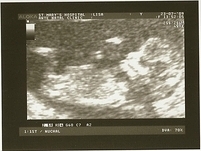 090723_baby2_12_wk_scan_02