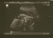 090923_baby2_20_wk_scan_03